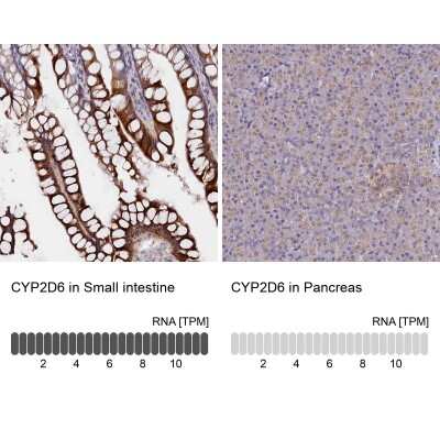 Immunohistochemistry-Paraffin: Cytochrome P450 2D6 Antibody [NBP1-91818]