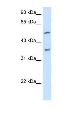 Western Blot: Cytochrome P450 2D6 Antibody [NBP1-62389]