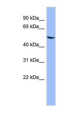 Western Blot: Cytochrome P450 2D6 Antibody [NBP1-69671]