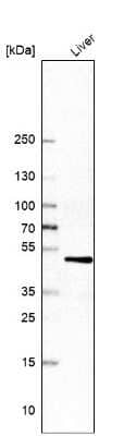 Western Blot: Cytochrome P450 2D6 Antibody [NBP1-91818]