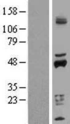 Western Blot: Cytochrome P450 2D6 Overexpression Lysate [NBP2-11031]