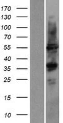 Western Blot: Cytochrome P450 2D6 Overexpression Lysate [NBP2-11167]