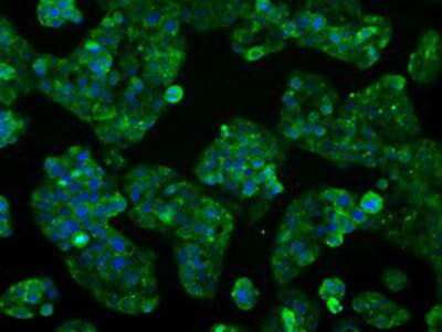 Immunocytochemistry/ Immunofluorescence: Cytochrome P450 2E1 Antibody (OTI5B9) [NBP2-02155]