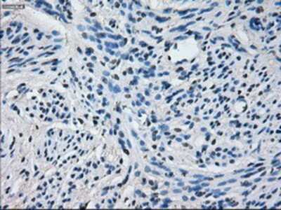 Immunohistochemistry-Paraffin: Cytochrome P450 2E1 Antibody (OTI5B9) [NBP2-02155]
