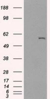 Western Blot: Cytochrome P450 2E1 Antibody (OTI5B9) [NBP2-02155]