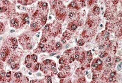 Immunohistochemistry-Paraffin: Cytochrome P450 2E1 Antibody [NBP1-52087]