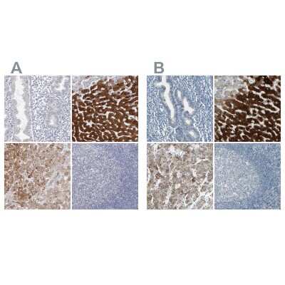 Immunohistochemistry-Paraffin: Cytochrome P450 2E1 Antibody [NBP1-85366]