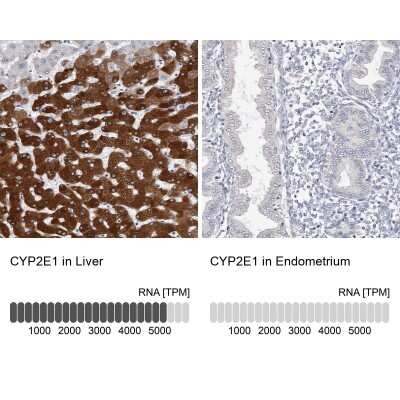 Immunohistochemistry-Paraffin: Cytochrome P450 2E1 Antibody [NBP1-85366]