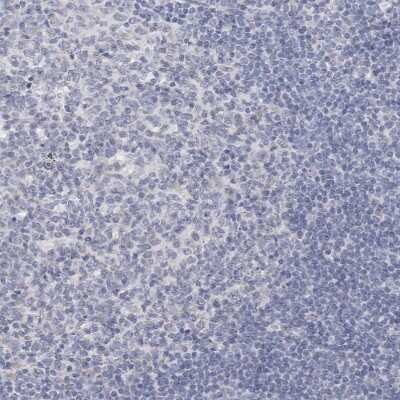 Immunohistochemistry-Paraffin: Cytochrome P450 2E1 Antibody [NBP1-85366]