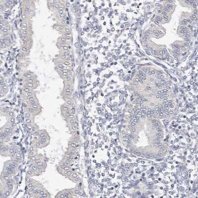 Immunohistochemistry-Paraffin: Cytochrome P450 2E1 Antibody [NBP1-85366]