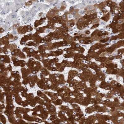Immunohistochemistry-Paraffin: Cytochrome P450 2E1 Antibody [NBP1-85366]