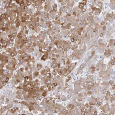 Immunohistochemistry-Paraffin: Cytochrome P450 2E1 Antibody [NBP1-85366]