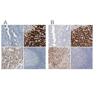 Immunohistochemistry-Paraffin: Cytochrome P450 2E1 Antibody [NBP1-85367]