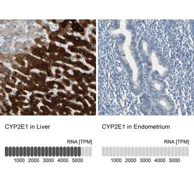 Immunohistochemistry-Paraffin: Cytochrome P450 2E1 Antibody [NBP1-85367]