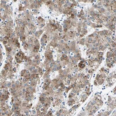 Immunohistochemistry-Paraffin: Cytochrome P450 2E1 Antibody [NBP1-85367]