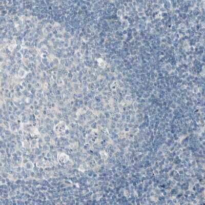 Immunohistochemistry-Paraffin: Cytochrome P450 2E1 Antibody [NBP1-85367]