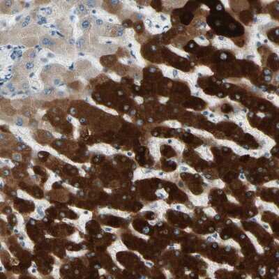 Immunohistochemistry-Paraffin: Cytochrome P450 2E1 Antibody [NBP1-85367]