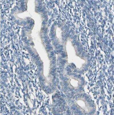 Immunohistochemistry-Paraffin: Cytochrome P450 2E1 Antibody [NBP1-85367]