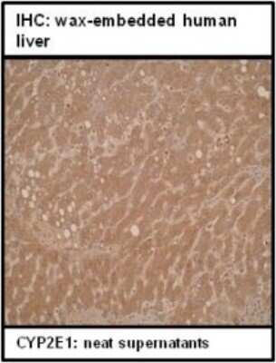 Immunohistochemistry: Cytochrome P450 2E1 Antibody (M12P4H2) - BSA Free [NBP2-50203]