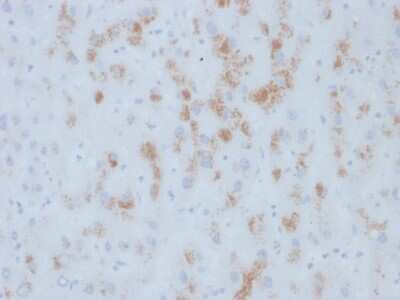 Immunohistochemistry-Paraffin: Cytochrome P450 2E1 Antibody (M12P4H2) [NBP3-07825]