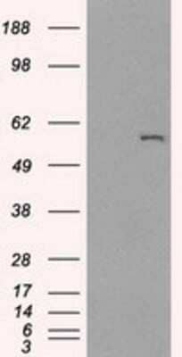 Western Blot: Cytochrome P450 2E1 Antibody (OTI5B9)Azide and BSA Free [NBP2-70531]