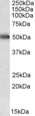 Western Blot: Cytochrome P450 2E1 Antibody [NBP1-52087]