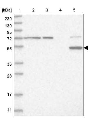 Western Blot: Cytochrome P450 2E1 Antibody [NBP1-85366]