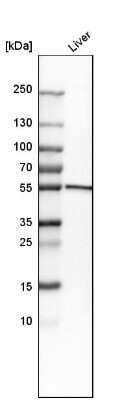 Western Blot: Cytochrome P450 2E1 Antibody [NBP1-85367]