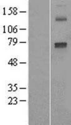 Western Blot: Cytochrome P450 2E1 Overexpression Lysate [NBL1-09687]