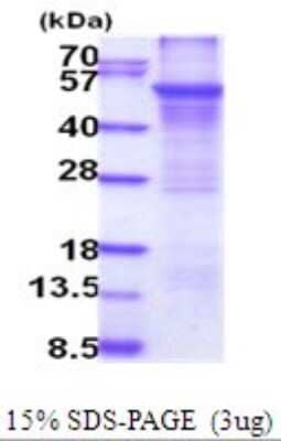 SDS-PAGE: Recombinant Human Cytochrome P450 2E1 His Protein [NBP2-51999]