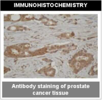 Immunohistochemistry: Cytochrome P450 3A4/3A5 Antibody (F24P2B10) - BSA Free [NBP2-50208]
