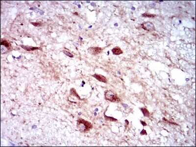 Immunohistochemistry-Paraffin: Cytochrome P450 3A4 Antibody (3H8) - BSA Free [NBP2-37502]