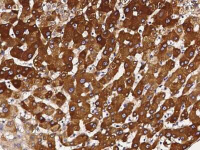 Immunohistochemistry-Paraffin: Cytochrome P450 3A4 Antibody [NBP2-99089]