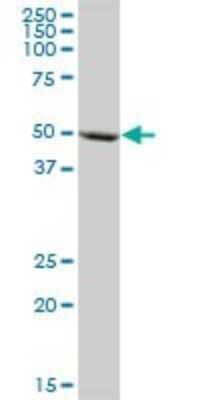 Western Blot: Cytochrome P450 3A5 Antibody [H00001577-B01P]