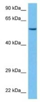 Western Blot: Cytochrome P450 3A5 Antibody [NBP3-10842]