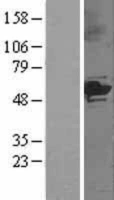 Western Blot: Cytochrome P450 3A5 Overexpression Lysate [NBL1-09693]