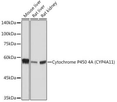 Western Blot: Cytochrome P450 4A Antibody (10D10W7) [NBP3-15847]