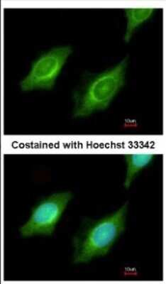Immunocytochemistry/ Immunofluorescence: Cytochrome P450 4A Antibody [NBP2-16081]