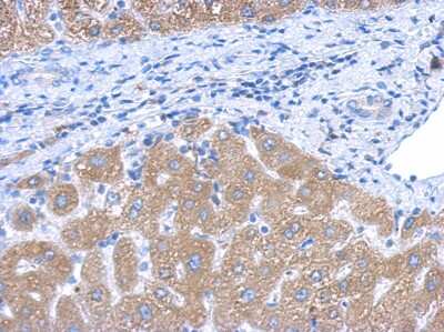 Immunohistochemistry-Paraffin: Cytochrome P450 4A Antibody [NBP2-16081]