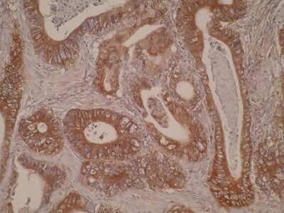 Immunohistochemistry: Cytochrome P450 4A Antibody (M25-P2A10) - BSA Free [NBP2-50212]