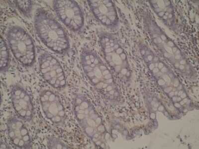 Immunohistochemistry: Cytochrome P450 4A Antibody (M25-P2A10) - BSA Free [NBP2-50212]