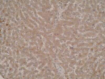 Immunohistochemistry: Cytochrome P450 4A Antibody (M25-P2A10) - BSA Free [NBP2-50212]