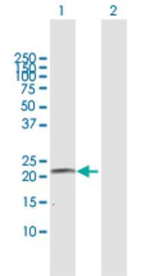 Western Blot: Cytochrome P450 4A Antibody [H00001579-B01P]