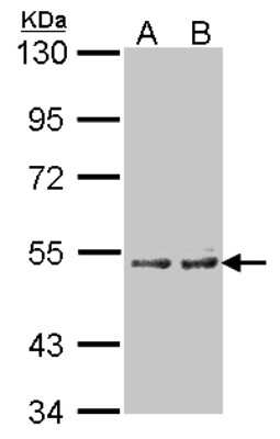 Western Blot: Cytochrome P450 4A Antibody [NBP1-31427]