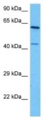 Western Blot: Cytochrome P450 4A Antibody [NBP3-10812]