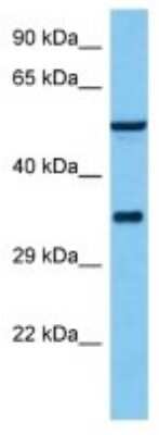 Western Blot: Cytochrome P450 4A1, 2C11 Antibody [NBP3-10122]
