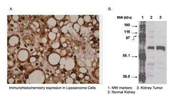 Immunohistochemistry: Cytochrome P450 4F11 Antibody (F21 P6 F5) [NBP2-66614]