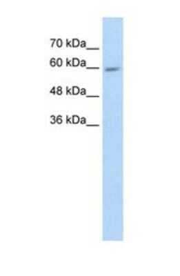 Western Blot: Cytochrome P450 4F11 Antibody [NBP1-69423]