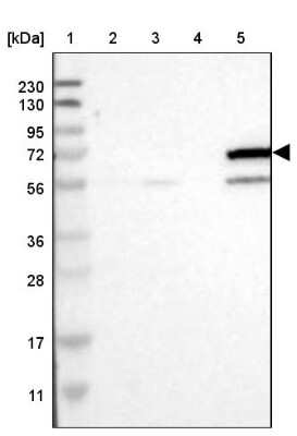 Western Blot: Cytochrome P450 4F11 Antibody [NBP1-87461]