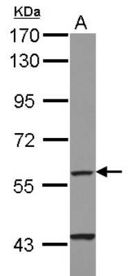 Western Blot: Cytochrome P450 4F11 Antibody [NBP2-16082]